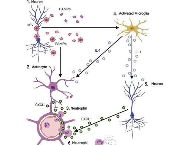 Study shows immune cells contribute to brain infection